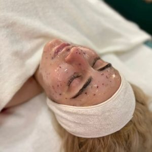 IMG_0277
